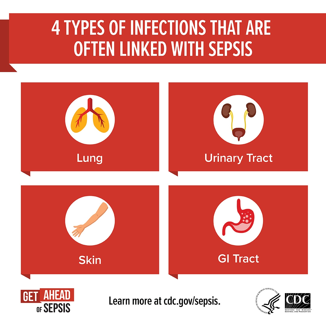 Get Ahead Of Sepsis Materials For Patients Sepsis CDC